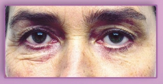 Сыворотка под глаза против морщин SKIN DOCTORS Instant Eyelift